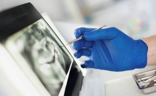 Znaczenie dokładności obrazowania RTG zębów w leczeniu endodontycznym