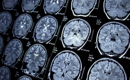 Jakie badania diagnostyczne przeprowadza neurolog w celu oceny zdrowia mózgu?
