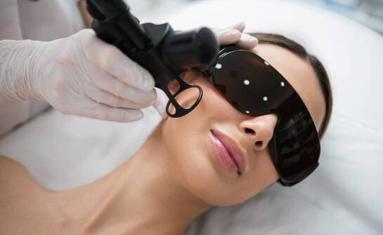 Zastosowanie laseroterapii w redukcji naczynek na twarzy