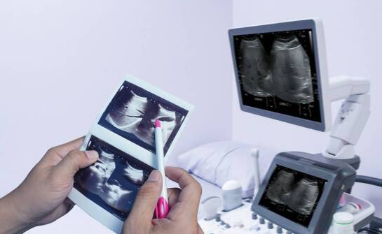 Czym jest histerosalpingografia i jak pomaga w diagnostyce niedrożności jajowodów?