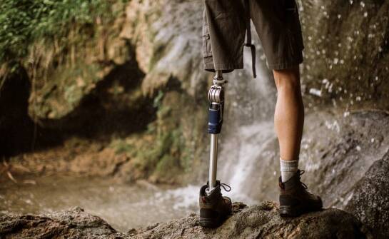 Zalety protezy hybrydowej w porównaniu do bionicznych rozwiązań