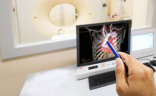 Jak nowoczesna diagnostyka wpływa na skuteczność terapii naczyniowych?