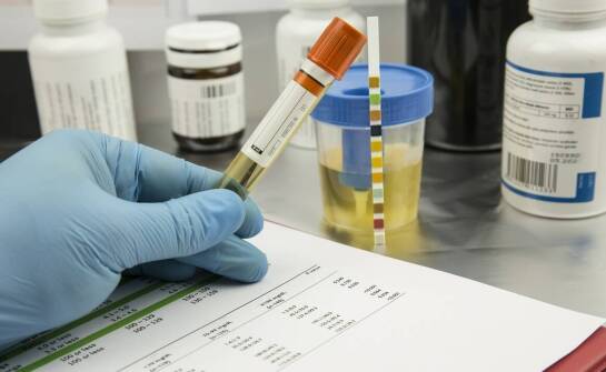 Alkohol i jego wpływ na proces diagnostyczny w badaniach krwi