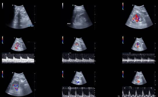 Jak ulepszona jakość obrazu w usg medison wpływa na precyzję diagnostyki?