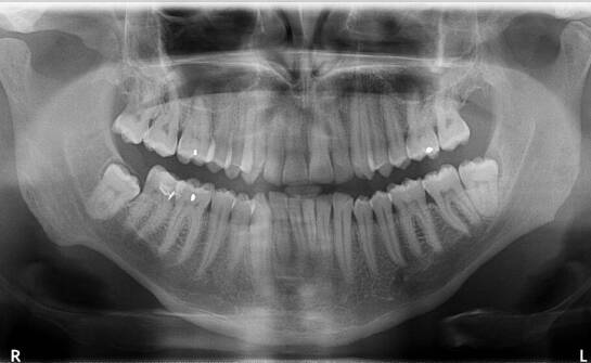 Jak radiowizjografia wspiera diagnostykę w stomatologii estetycznej?