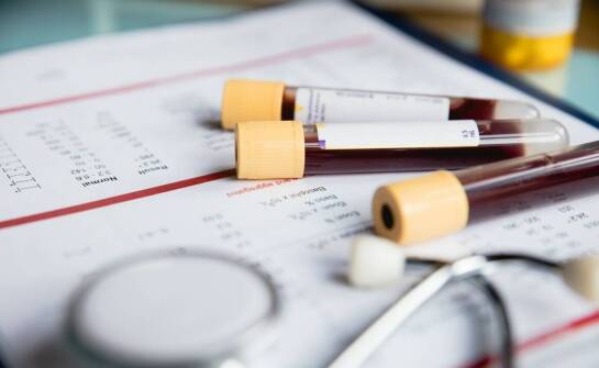 Czy badania genetyczne mogą pomóc w diagnozie problemów z włosami?