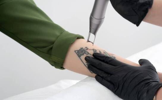 Rekonwalescencja po zabiegu usuwania tatuaży – jak dbać o skórę?