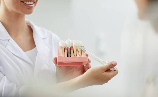 Wpływ implantów zębowych na jakość życia pacjentów