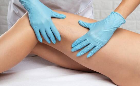 Co jest skuteczniejsze na pajączki - skleroterapia czy laser?