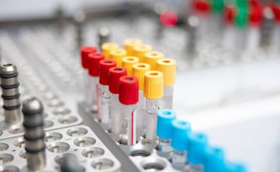 Jakie badania laboratoryjne są kluczowe dla pacjentów z cukrzycą?