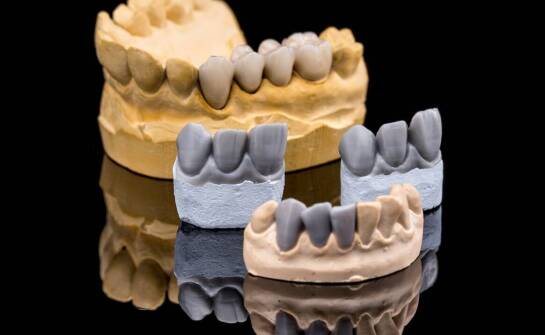 Jak wybrać wysokogatunkowy gips dentystyczny?