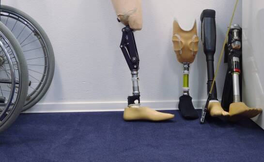 Innowacyjne technologie w tworzeniu protez podudzia – skaner 3D i drukarka 3D