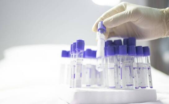 Jak analiza hormonalna wpływa na skuteczność terapii trychologicznej?