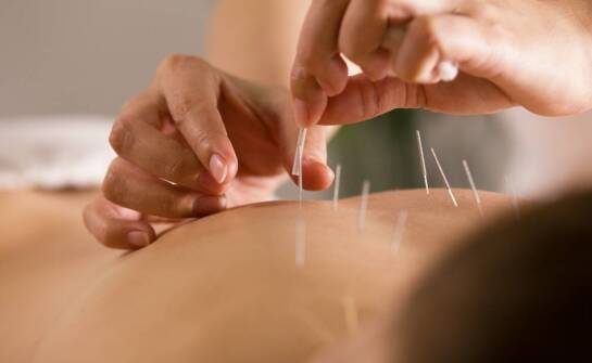 Czy akupunktura jest skuteczna na bóle kręgosłupa?