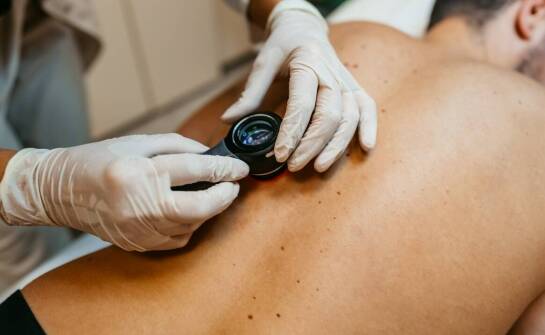 Kiedy warto sięgnąć po maść na świerzb bez recepty?