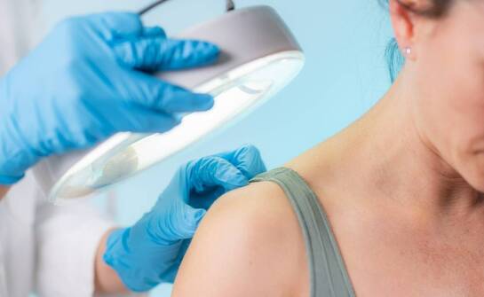 Jak ocenić znamiona skórne przed decyzją o ich usunięciu?