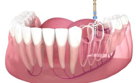 Endodoncja pod mikroskopem: jak technologia zmienia skuteczność leczenia kanałowego