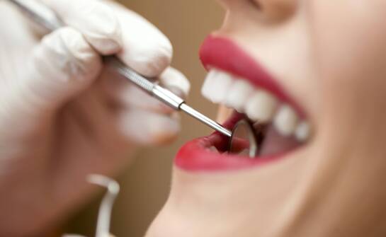 Jakie są wymagania dotyczące higieny jamy ustnej po założeniu licówek?