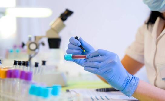 Znaczenie PCR w precyzyjnej identyfikacji materiału genetycznego patogenów