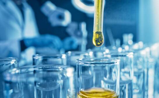 Jak analiza moczu wspiera diagnostykę chorób układu moczowego?