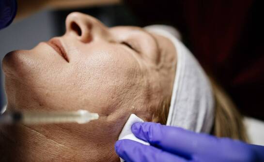 Kwas hialuronowy w terapiach anti-aging