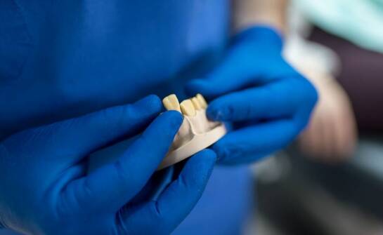 Dlaczego jakość materiałów jest kluczowa przy produkcji koron porcelanowych?