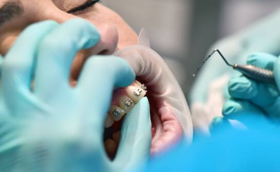 Jak nowoczesne rozwiązania wspierają leczenie ortodontyczne?