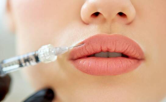 Wypełnianie kwasem hialuronowym: korzyści i efekty zabiegu