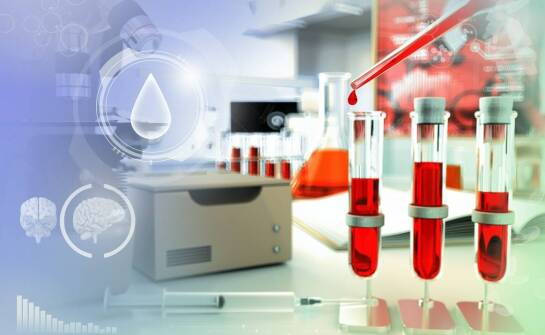 Wpływ nawodnienia na wyniki badań krwi: co musisz wiedzieć
