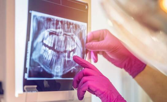 Rola RTG dental w estetyce uśmiechu – jak wspomaga planowanie zabiegów?