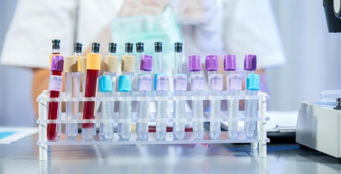 Jak dbałość o jakość paliw wpływa na wydajność silników?