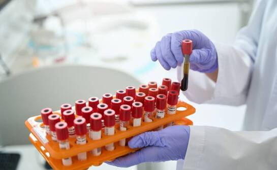 Zabiegi z osoczem bogatopłytkowym a choroby tarczycy: co warto wiedzieć?