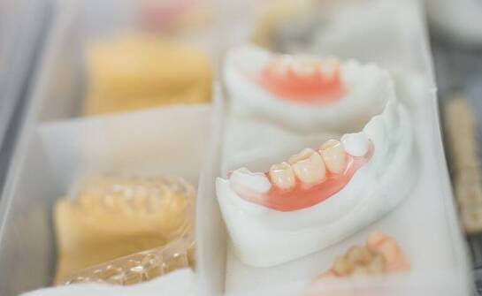 Wybór materiałów do implantów dentystycznych – co warto wiedzieć?