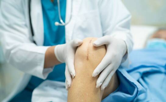 Efektywność osteotomii w leczeniu niestabilności rzepki