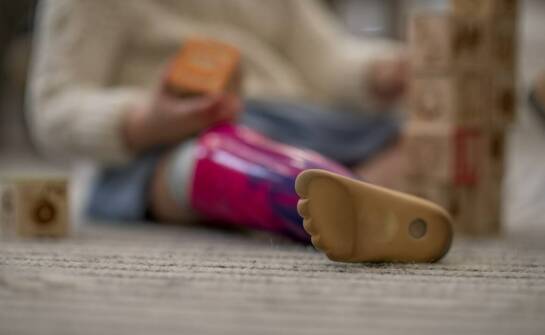 Wpływ skarpety silikonowej na ochronę kikuta i zdrowie skóry