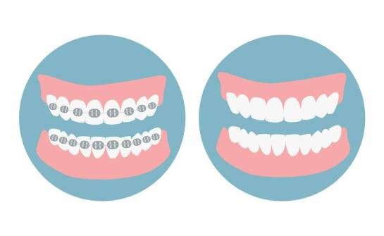 Lakowanie i lakierowanie – skuteczna profilaktyka zdrowych zębów dzieci i dorosłych