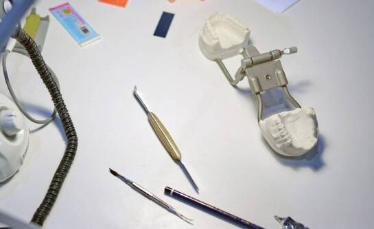 Protetyka stomatologiczna – najważniejsze informacje o odbudowie uśmiechu