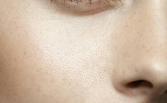 Mezoterapia igłowa – skuteczna metoda poprawy kondycji skóry