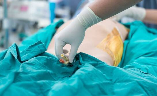 Balsamacja – znaczenie i zastosowanie w przygotowaniu ciała do pochówku