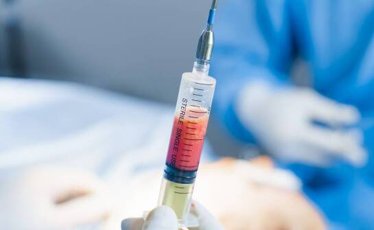 Lipo lab dawkowanie – co mówi o tym najnowsza medycyna estetyczna?