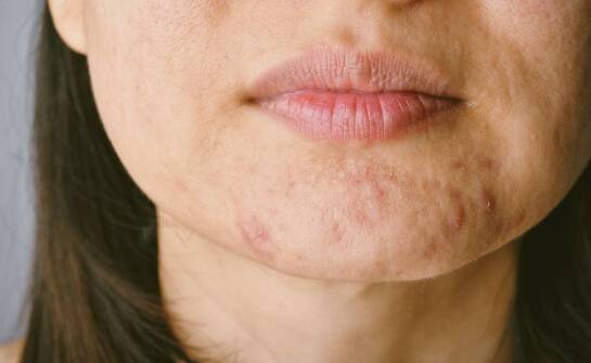 Jak dbać o zdrowie jamy ustnej i kiedy warto odwiedzić stomatologa