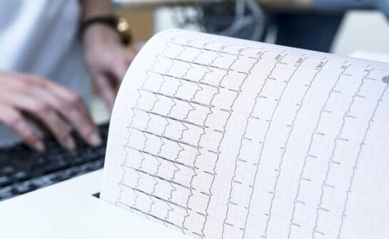 Badanie EEG – na czym polega, kiedy się je wykonuje i co wykrywa?