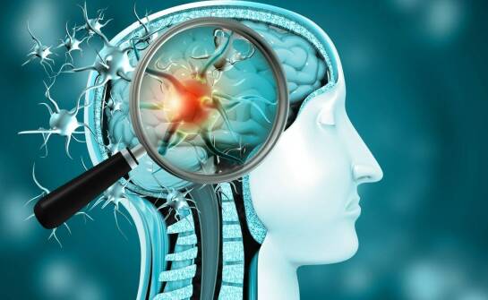 Najczęstsze schorzenia układu nerwowego – objawy, diagnoza, leczenie