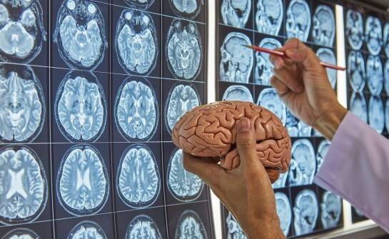 Jak rozpoznać udar mózgu? Najważniejsze objawy i sposoby reagowania