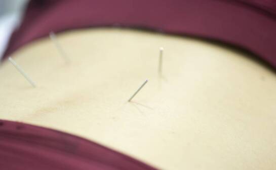 Mezoterapia igłowa Dr Cyj – jak działa i jakie efekty można uzyskać