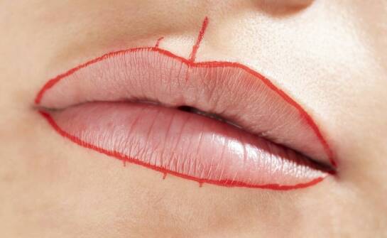 Wypełniacze do ust – wszystko, co warto wiedzieć przed zabiegiem