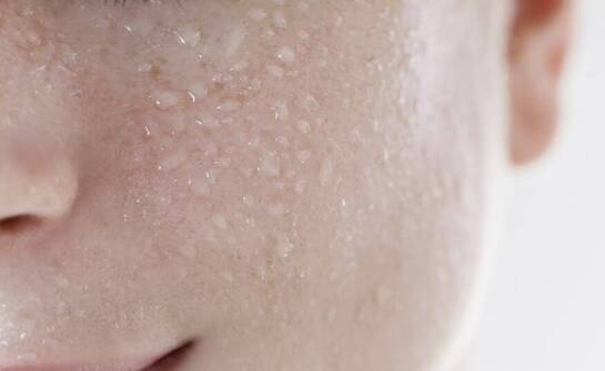 Jak działają kwasy w pielęgnacji cery trądzikowej i które wybrać?