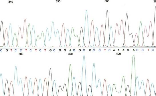 Jak działa tandemowy spektrometr mas GCMS/M i do czego znajduje zastosowanie