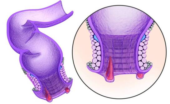 Labioplastyka – najważniejsze informacje, wskazania i możliwe efekty zabiegu