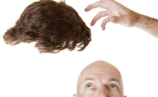 Najważniejsze informacje o zabiegu przeszczepu włosów – wskazania i efekty